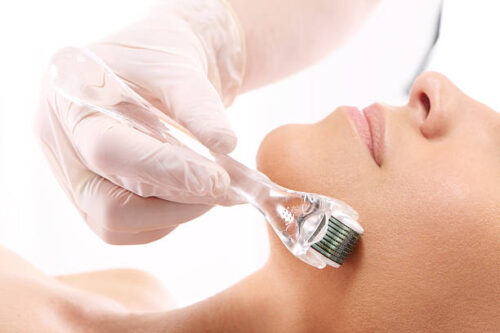 Playa del Carmen microneedling dermapen skin treatment certified esthetician Skinbar by Andrea Zuñiga